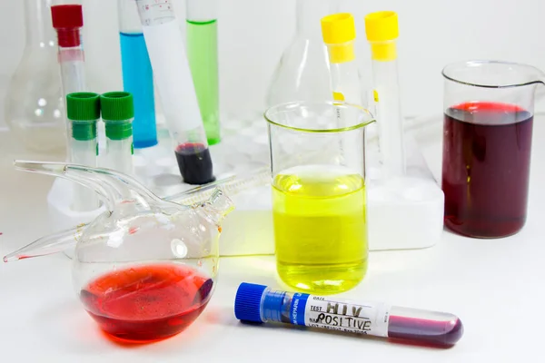 Зразок Аналізу Крові Діагностика Лабораторні Хімічні Рідкі Елементи Студійна Стрілянина — стокове фото