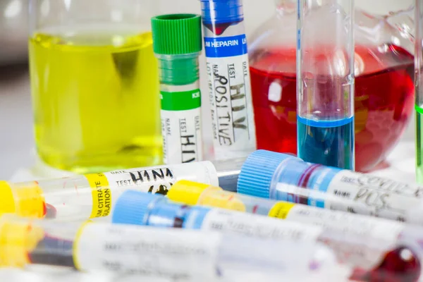 H1N1 Swine Influenza Diagnoses Lab Tests Blood Test Tube Samples — Stock Photo, Image