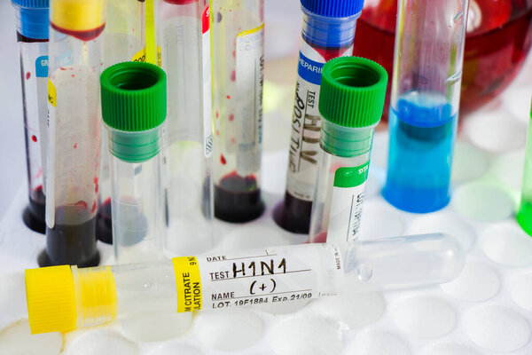 H1N1 свиной грипп, диагнозы и лабораторные тесты, образцы пробирки крови, текст и письмо. Студия съемки на белом фоне.