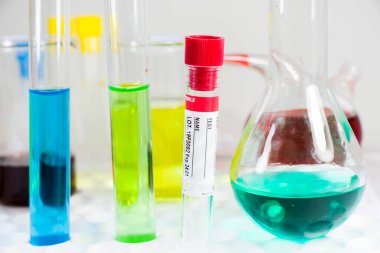 İsimsiz kan testi tüpü örneği, metin için boş alan, laboratuvar arka planı, kopyalama yapıştırıcısı.