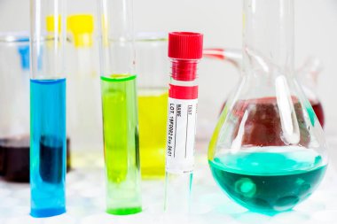 İsimsiz kan testi tüpü örneği, metin için boş alan, laboratuvar arka planı, kopyalama yapıştırıcısı.