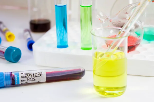 Covid Coronavirus Covid Blood Test Tube Sample Laboratory Diagnosis — Stock Photo, Image