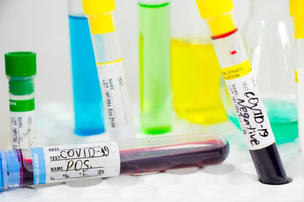 Covid Corona Virus Blood Test Sample Negative Positive Tests Reagents — стоковое фото