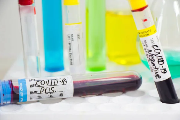 Ковід Корона Вірусний Аналіз Крові Негативні Позитивні Тести Реагенти Скляний — стокове фото