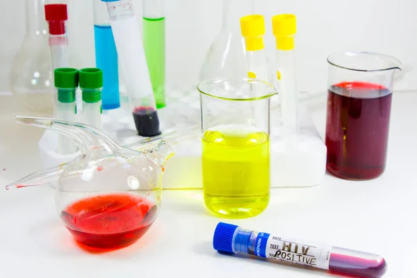 Hiv Test Blood Tube Laboratory Glasses Instruments Viruses Research Studio — Stock Photo, Image