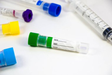 Kimyasal laboratuvar aletleri, cam eşyalar ve pipetler. Laboratuvarda testler ve araştırmalar.