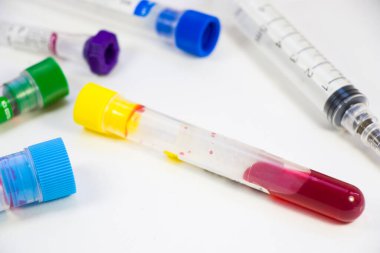 Kimyasal laboratuvar aletleri, cam eşyalar ve pipetler. Laboratuvarda testler ve araştırmalar.