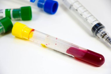 Kimyasal laboratuvar aletleri, cam eşyalar ve pipetler. Laboratuvarda testler ve araştırmalar.