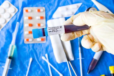 Beyaz arka planda Corona virüsü negatif kan test tüpleri, stüdyo çekimi. Kan testi örnekleri. Teşhis ve laboratuvar.