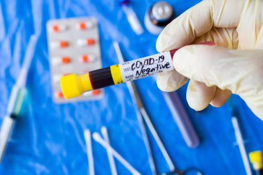 Beyaz arka planda Corona virüsü negatif kan test tüpleri, stüdyo çekimi. Kan testi örnekleri. Teşhis ve laboratuvar.