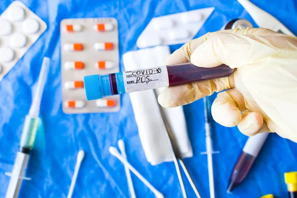 Beyaz arka planda Corona virüsü negatif kan test tüpleri, stüdyo çekimi. Kan testi örnekleri. Teşhis ve laboratuvar.