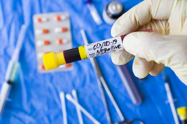 Beyaz arka planda Corona virüsü negatif kan test tüpleri, stüdyo çekimi. Kan testi örnekleri. Teşhis ve laboratuvar.