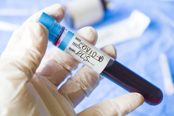 Tubos Análisis Sangre Positivos Para Virus Corona Fondo Blanco Sesión —  Fotos de Stock