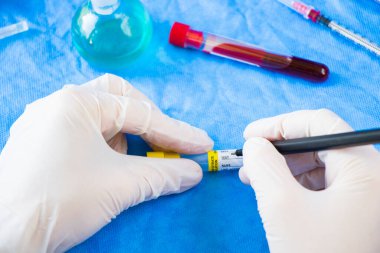 Laboratuvarda üniformalı bir doktor kan tüpü örneğine beyaz eldiven yazdı.