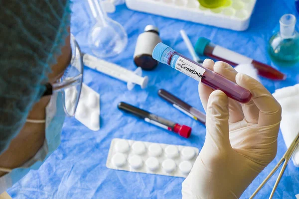 Doktorlarda kreatinin kan testi tüpü örneği. Laboratuvarda el ele, doktorların yüzü...