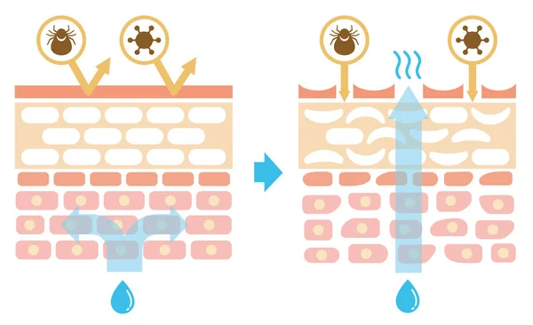 皮膚の断面図健康的な皮膚と負傷した皮膚の保護効果の比較図 テキストなし — ストックベクタ
