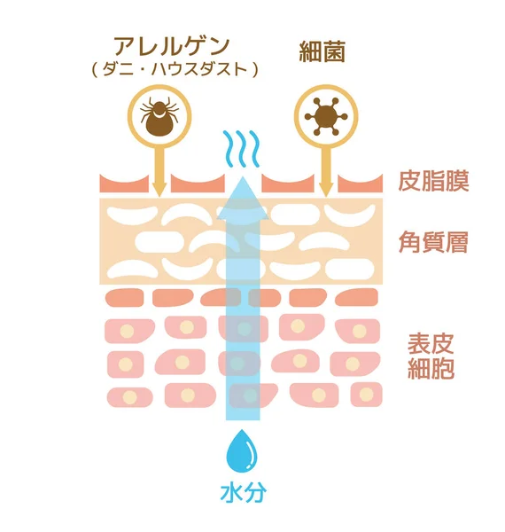 Schnittansicht Der Haut Der Verletzten Haut Japanisch — Stockvektor