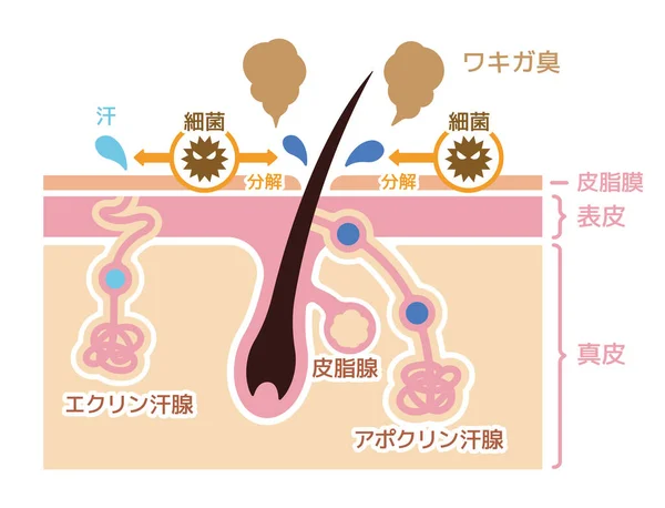Cause Body Odor Vector Flat Illustration Japanese — Stock Vector