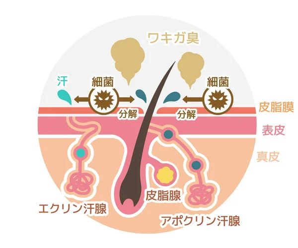 Ursache Des Körpergeruchvektors Flache Abbildung Runde Form Japanisch — Stockvektor