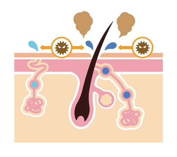 Cause Odeur Corporelle Vecteur Plat Illustration Pas Texte — Image vectorielle