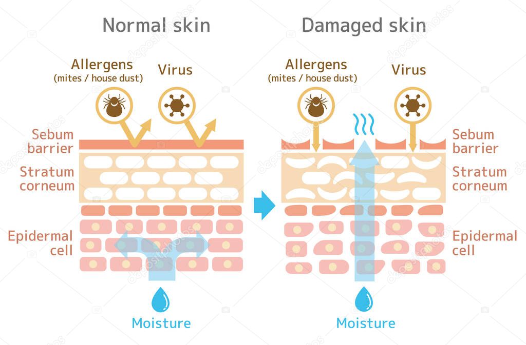 Sectional view of the skin.Comparison illustration of protection effect between healthy skin and wounded skin 