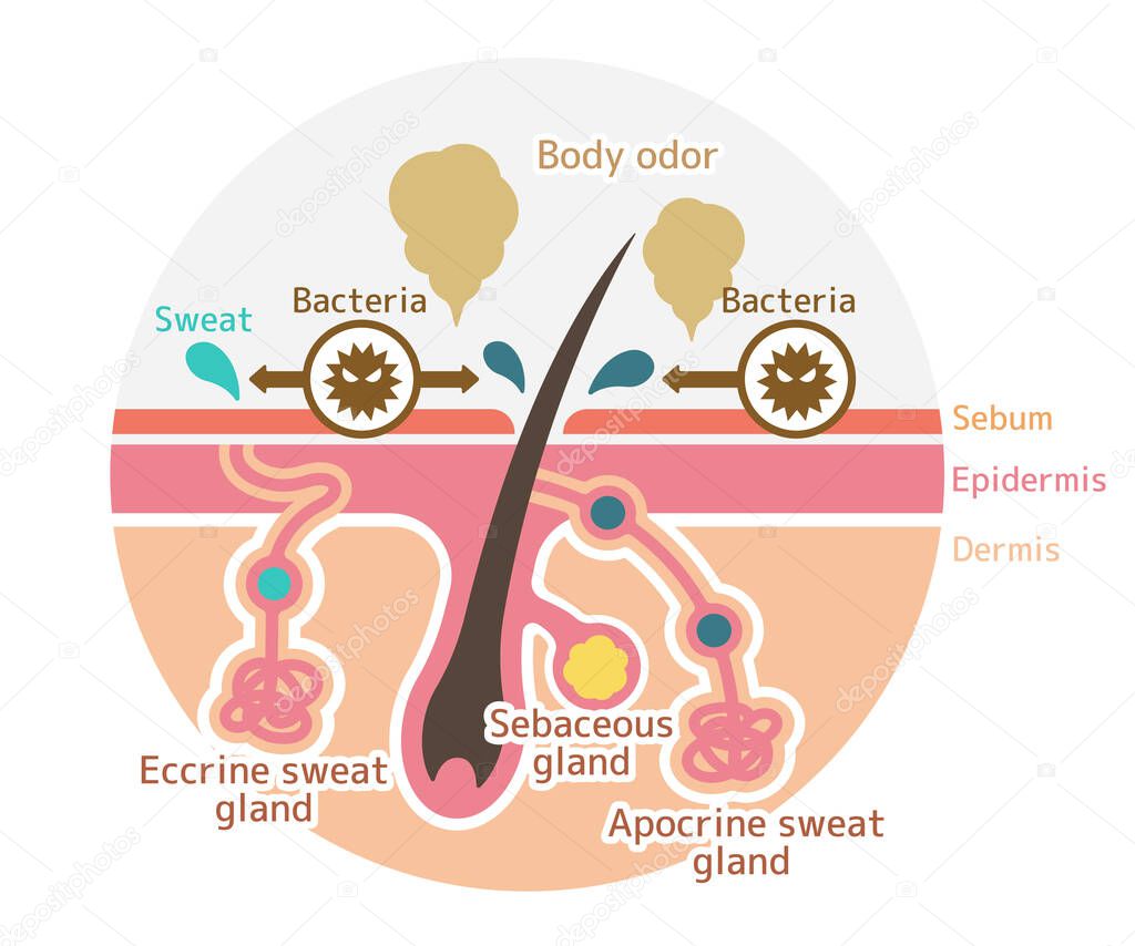 Cause of body odor vector flat illustration(round shape).