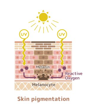mechanism of skin pigmentation / skin spot illustration clipart