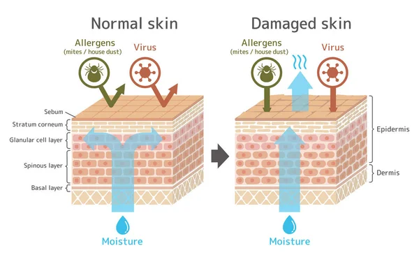Schnittansicht Der Haut Vergleich Der Schutzwirkung Zwischen Gesunder Und Verletzter — Stockvektor