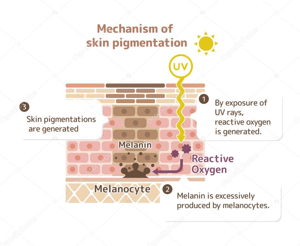 mechanism of skin pigmentation / skin spot illustration