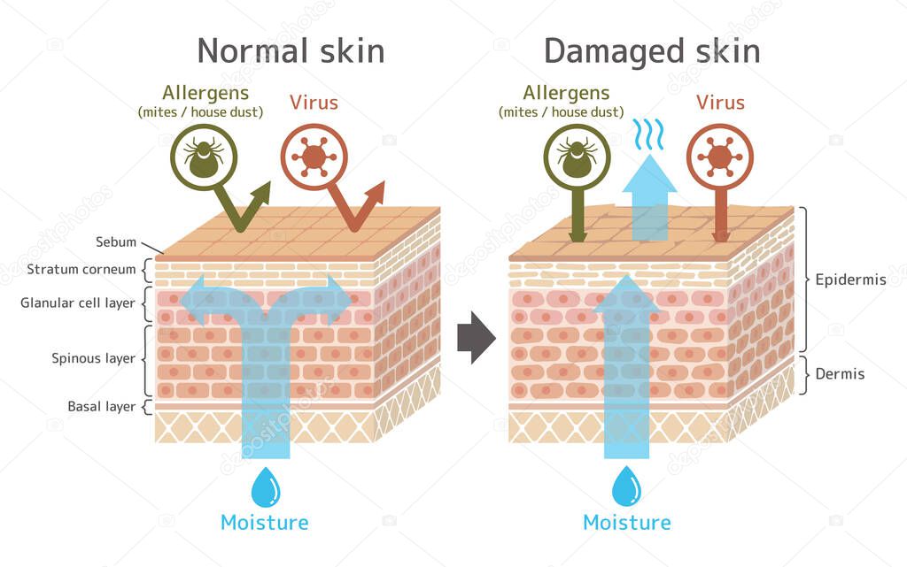 Sectional view of the skin.Comparison illustration of protection effect between healthy skin and wounded skin