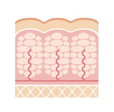 Selülit 'in cilt bölümsel görünümü