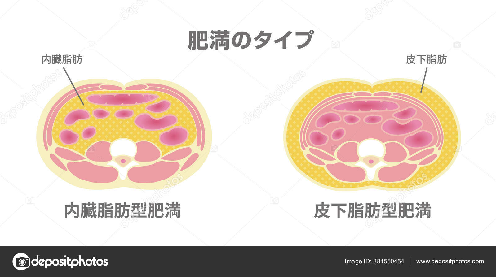肥満のイラストの種類 腹部断面図 内臓脂肪皮下脂肪 ストックベクター C Barks