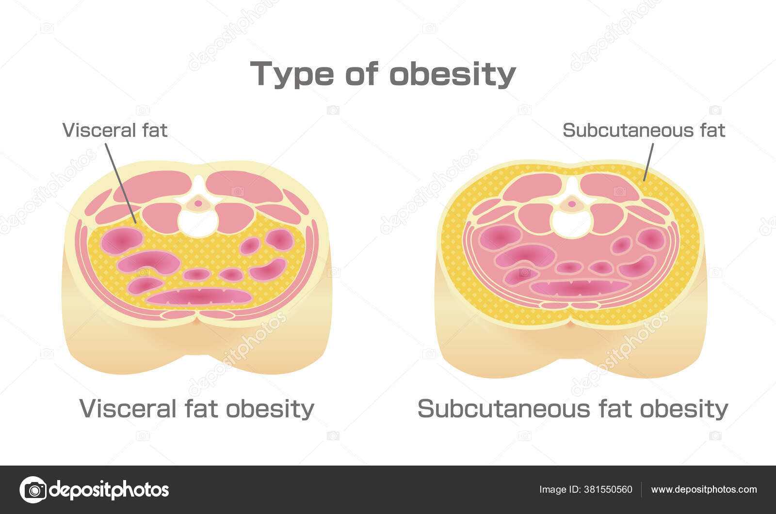Abdominal Subcutanea Eliminar Grasa Visceral Mujer Grasa