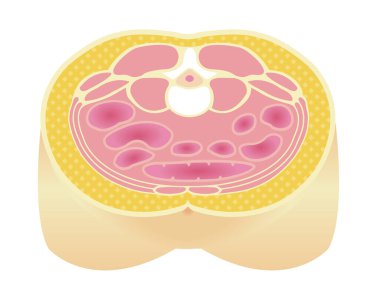 Obezite illüstrasyonu. Abdominal Kısmi Görünüm (deri altı yağ).