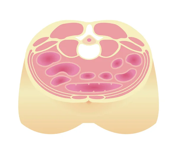 Tipo Ilustração Obesidade Vista Seccional Abdominal Corpo Saudável Tipo Padrão —  Vetores de Stock