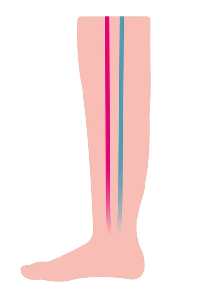 Silhueta Perna Plana Ilustração Com Artéria Veia — Vetor de Stock