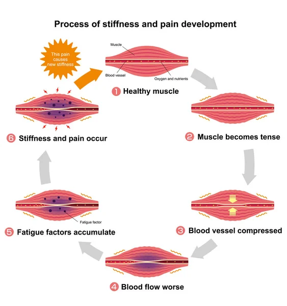 Proceso Rigidez Muscular Ilustración Del Tipo Dolor Círculo — Archivo Imágenes Vectoriales