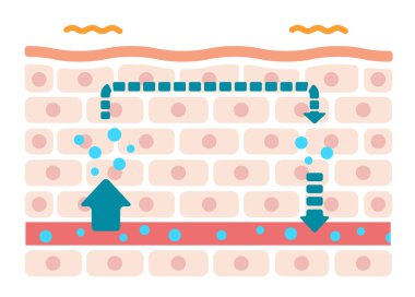 Şişmiş cilt durumunun resmedilmesi (rutubet dolaşımının bozulması)).