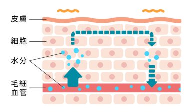Şişmiş cilt durumunun resmedilmesi (rutubet dolaşımının bozulması)).