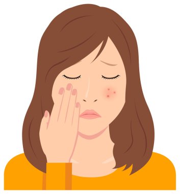 Genç kadın vektör illüstrasyonu (üst vücut) / sivilce, sivilce, çil, kızarıklık