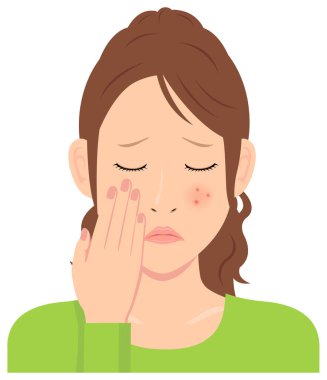 Genç kadın vektör illüstrasyonu (üst vücut) / sivilce, sivilce, çil, kızarıklık