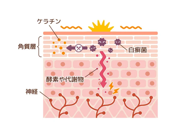 Generation Mechanisim Athlete Foot Ringworm Vector Illustration Japanese — Stock Vector