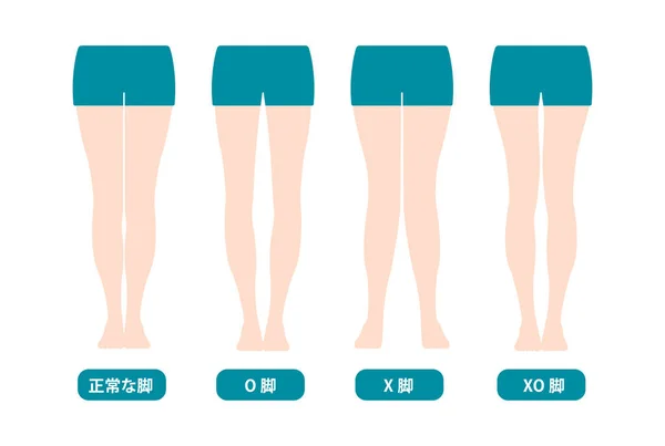 Farklı Bacak Türleri Açılar Dizler Vektör Çizimi Japonca — Stok Vektör