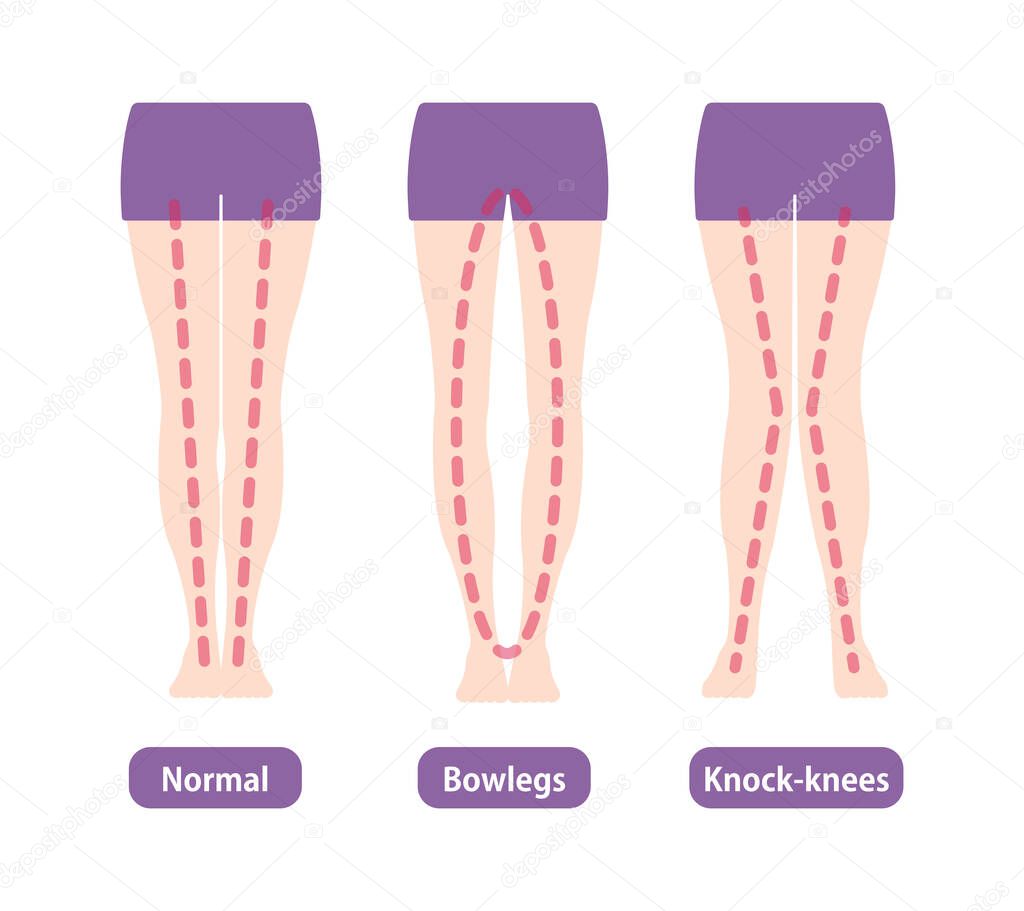 Difference types of legs angles and knees vector illustration