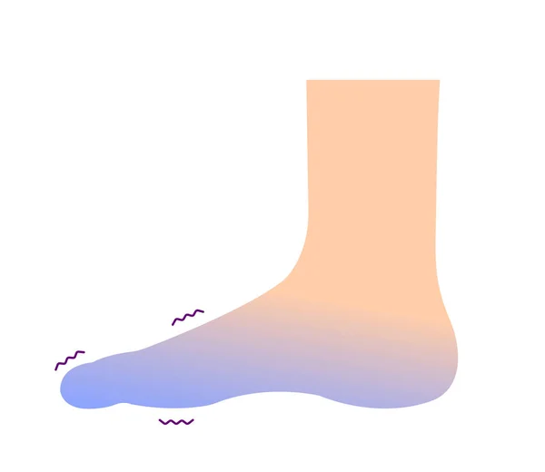 冷手部血液循环图例 冷脚趾的敏感性 — 图库矢量图片