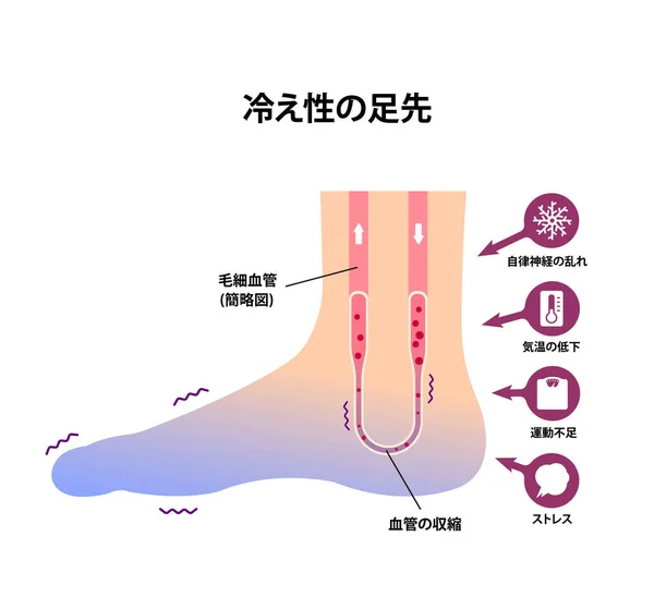 Durchblutung Des Kalten Fußes Empfindlichkeit Gegen Kalte Kalte Zehen Japanisch — Stockvektor