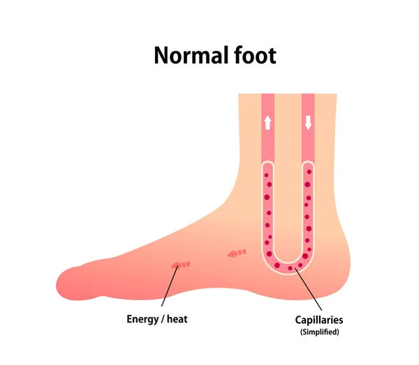 Normal Foot Blood Circulation Illustration — Stock Vector