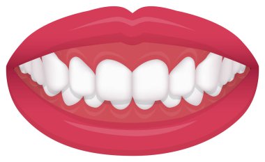 Teeth trouble ( bite type / crooked teeth ) vector illustration /Deep bite clipart