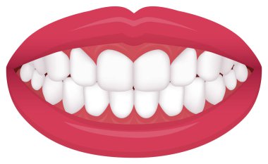 Diş sorunu (ısırık tipi / çarpık dişler) vektör çizimi / çift dişler., normal dişler 