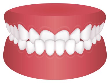Teeth trouble ( bite type ) vector illustration /Underbite clipart